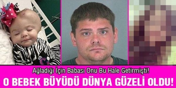 Ağlıyor diye babası tarafından…O Bebek Büyüdü ve Dünyalar Güzeli Oldu..