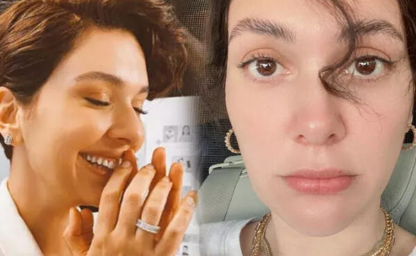 Bergüzar Korel: Burnum eski haline dönecek mi?