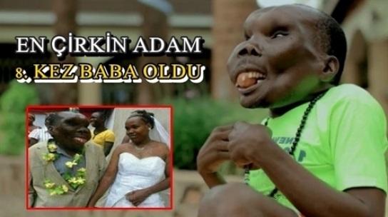 Uganda’ nın En Çirkin Adamı 8. Kez Baba Oldu- Çirkin Şansı Bu Olsa Gerek