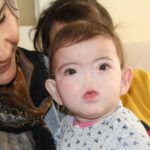 Burnu olmadan doğdu: Dünyada 13 kişide var, 4’ü Türkiye’de