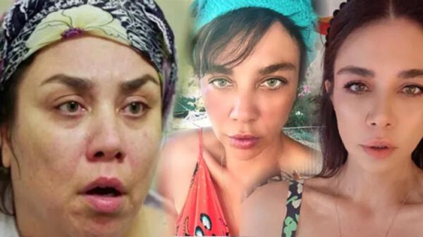 Yeşim Ceren Bozoğlu: 25’lik genç kızlar botoks yaptırıyor!