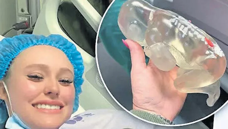 Aynı bebek ikinci kez doğacak