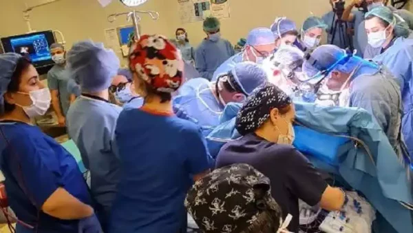 Siyam ikizleri Cezayirli bebekler İstanbul’da 9 saat süren ameliyat ile ayrıldı